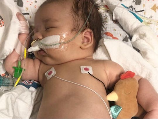 Family of infant battling botulism offers warning