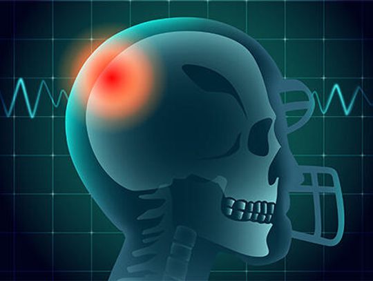 Technology, training are key in reducing concussion risks
