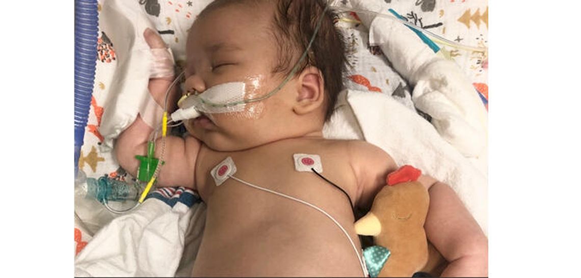 Family of infant battling botulism offers warning